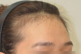 매몰법 전 BEFORE 1