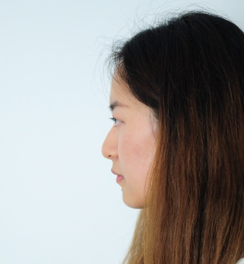 매몰법 전 BEFORE 1