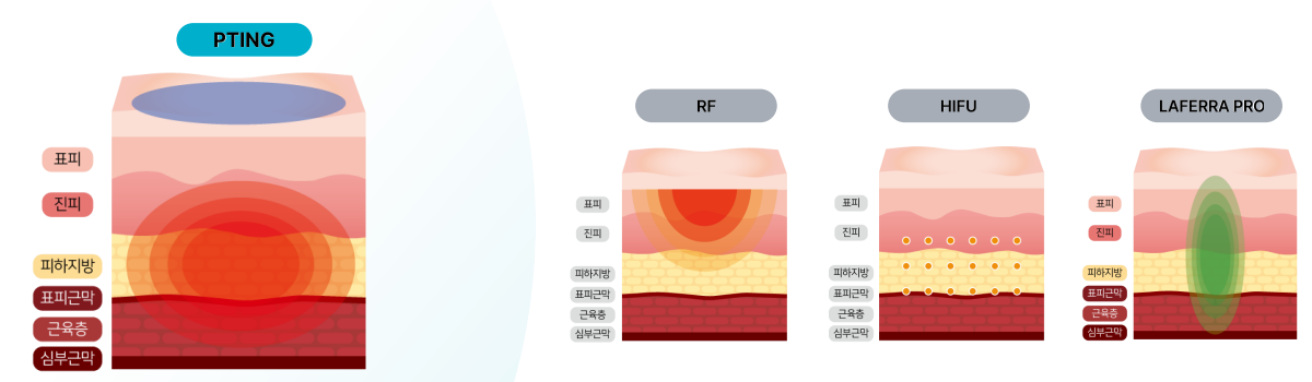 피팅리프팅 이미지